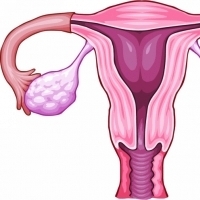 HPV – Rakovina děložního čípku